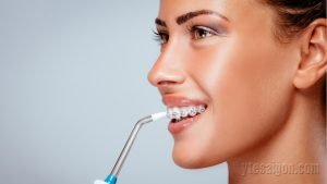 Máy tăm nước dành cho người niềng răng